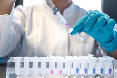 HIV'de umut veren ilaç