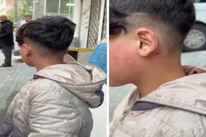 Bursa'da camı tıklattığı için çocuğu darp etti