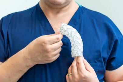 Sessiz katil: Aort anevrizması