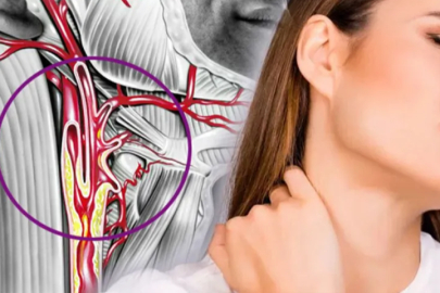 "Şah damarı hastalıkları felç riskini artırıyor"