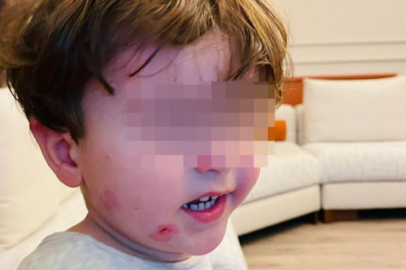 Bursa'da kreşe bıraktığı çocuğunu darp edilmiş halde aldı